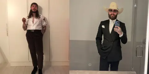 Post Malone Opens Up About His Weight Loss and Health Journey