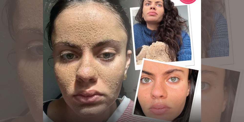 The Appeal and Risks of a ‘Caveman’ Skin-Care Routine