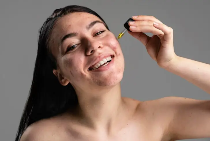 what are actives in skin care